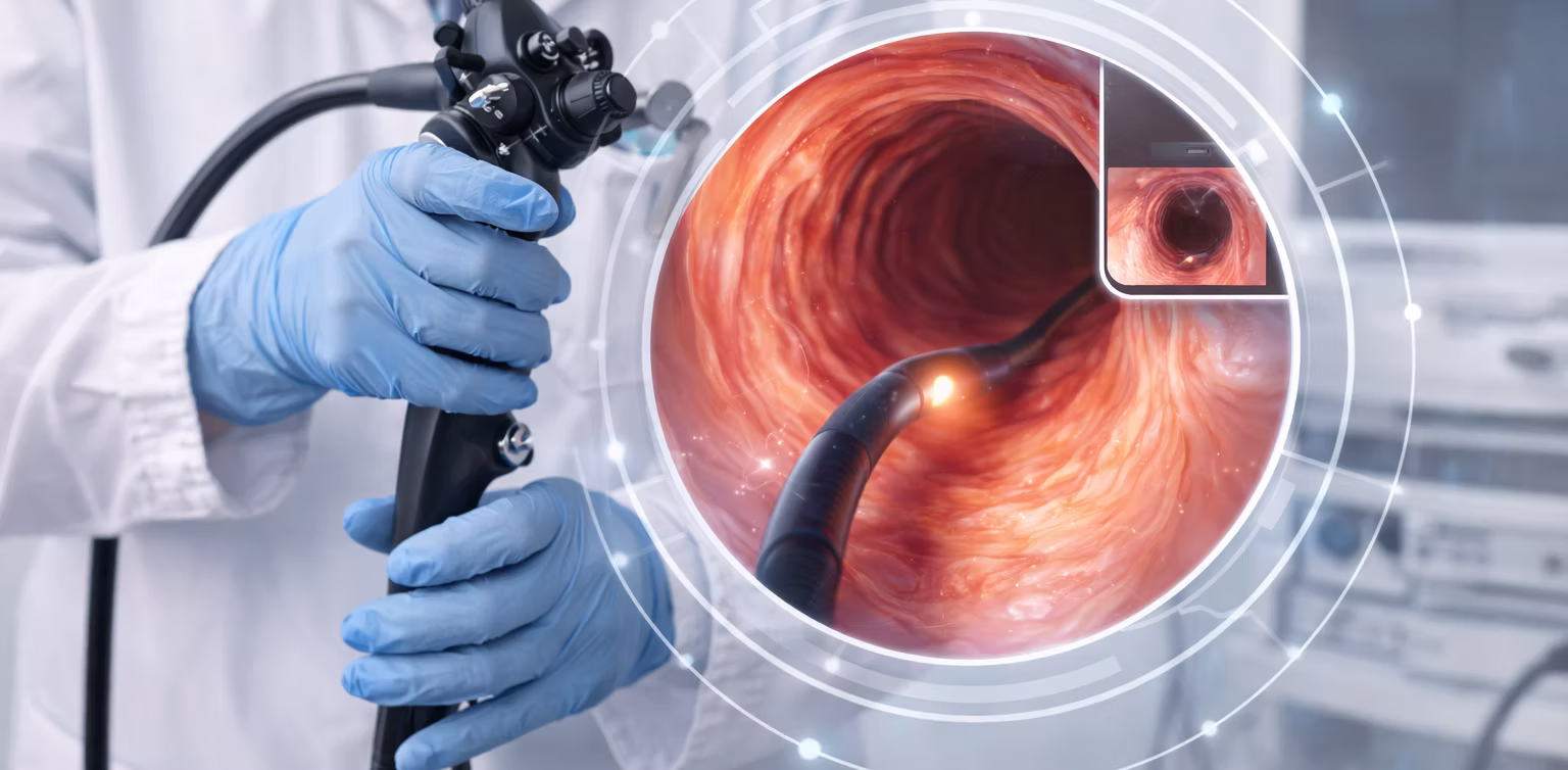 Endoscopía Bariátrica